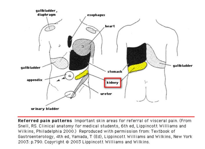 Kidney Pain Location Pictures Symptoms Causes Diagnosis