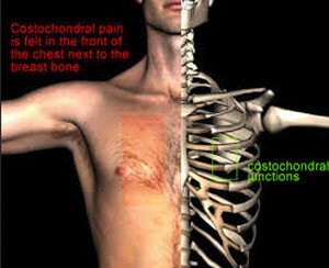 Pain under Right Rib Cage - (2018 - Updated)